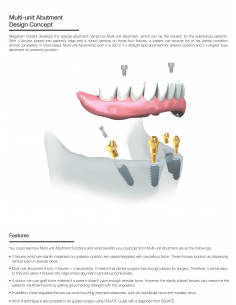 Multi Unit Abutment Angled 30 AnyRidge System 2