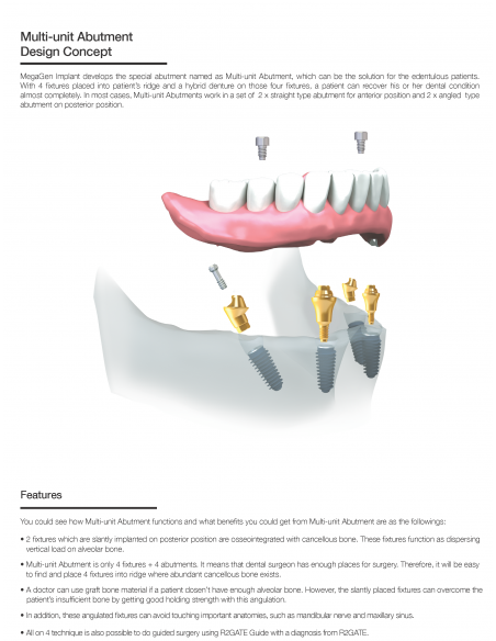 Multi Unit Abutment Temporary Cylinder  AnyRidge System