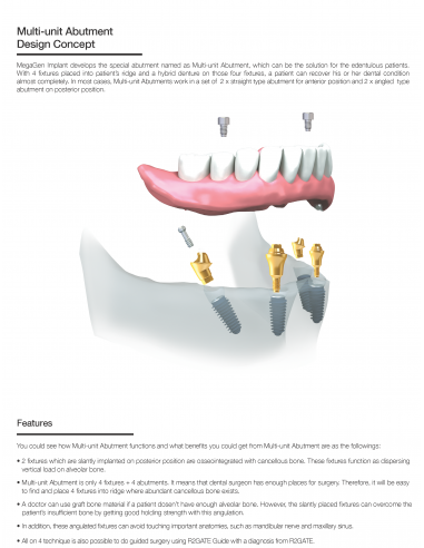 Multi Unit Abutment Straight AnyRidge